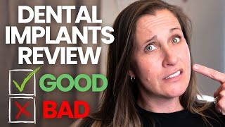 What I Didnt Like About My Dental Implants  4 Years Later [upl. by Nuahsyar]