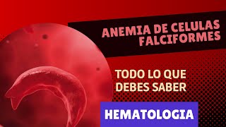 ANEMIA de Células Falciformes ¡Lo que debes saber  Hematología clínica [upl. by Odlanier200]