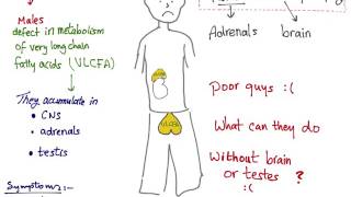 Adrenoleukodystrophy ALD mnemonic [upl. by Klug230]