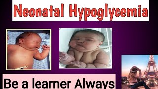 Neonatal Hypoglycemia [upl. by Lodnar]