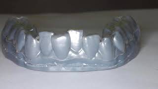 Clear Aligners 3D Printed by Nirenblatt Orthodontics [upl. by Sarat]