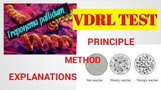 VDRL TestVDRL test procedureTreponema pallidum Microbilogysyphilis testSTDSTAR LABORATORY [upl. by Nivrem]