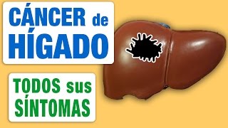 Todos los Síntomas del Cáncer de Hígado [upl. by Shippee]