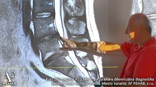 RTG MRI štrukturálna a diferenciálna diagnostika 2 MUDr Richard Smíšek SPS metóda SMSystém [upl. by Uda698]