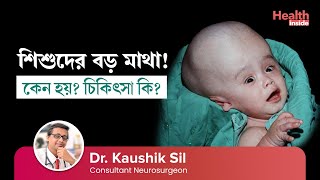 শিশুদের বড় মাথা বা হাইড্রোসেফালাস কি কারণ ও চিকিৎসা  Hydrocephalus and its treatment [upl. by Murrell443]