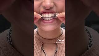 ANYSMILES TEETH WHITENING STRIPS FOR PERFECTLY WHITE TEETH 😁 BIGLOVER 360° 🪷 [upl. by Fries]