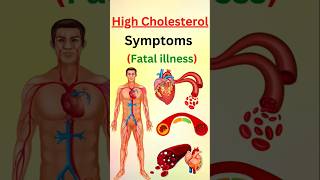 STOP Ignoring These Warning Signs of High Cholesterol [upl. by Sudhir568]