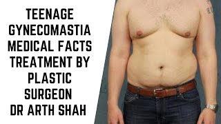 Teenage Gynecomastia Medical facts and Treatment options explained by Plastic Surgeon Dr Arth Shah [upl. by Ikcir]