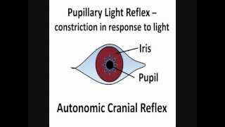 Pupillary Light Reflex  Cranial Nerves II amp III [upl. by Uhayile]