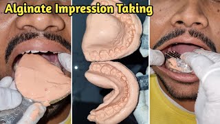 Alginate Impression Taking  Dental Impression  Alginate Impression [upl. by Ylrad]