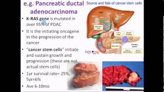 Pathophysiology 18 Etiology and Pathogenesis of Cancer [upl. by Annairol]