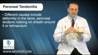 Peroneal Tendinitis is a Common Running Injury [upl. by Hannazus]