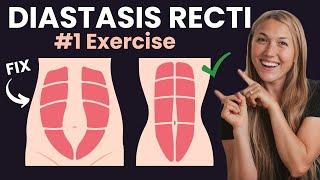 BEST Diastasis Recti Exercise To Strengthen Core  Postpartum Fitness Specialist [upl. by Aseena866]