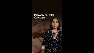 How to recover after a cesarean 🤱 [upl. by Alastair]