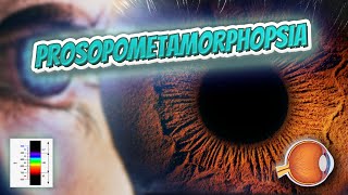 Prosopometamorphopsia  Your EYEBALLS  EYNTK 👁️👁️💉😳💊🔊💯✅ [upl. by Warenne]