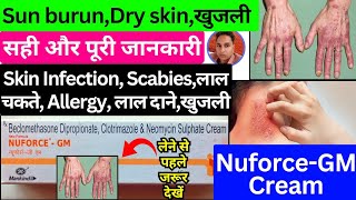 nuforce gm cream  nuforce gm  nuforce gm cream uses in telugu  nuforce gm cream kannada  Nuforce [upl. by Auqenaj]