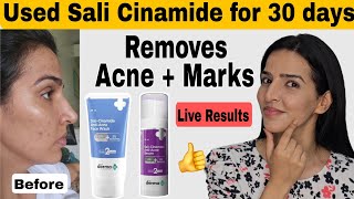 I tried Derma co Sali cinamide serum  Removes pimples and acne marks acne [upl. by Carry888]