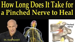 How Long Does It Take For A Pinched Nerve to Heal  Dr Mandell [upl. by Talmud561]