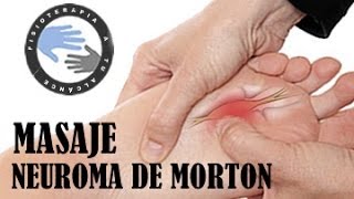 Neuroma de Morton tratamiento y fisioterapia [upl. by Nojad]