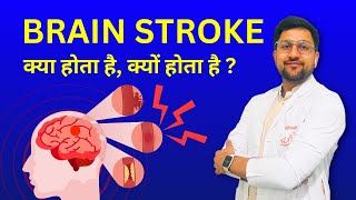 Stroke Kya Hota Hai Kaise Hota Hai Causes of Brain Stroke  Ischemic amp Hemorrhagic Stroke in Hindi [upl. by Dahsraf]