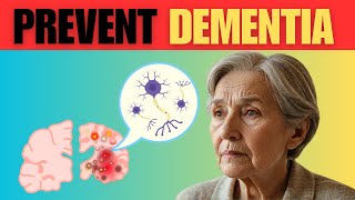 The Early Signs of Dementia and How to Prevent It [upl. by Aurelia]