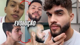 Evolução Minoxidil dos INSCRITOS  Barba ANTES E DEPOIS 🧔 [upl. by Samanthia]