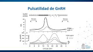 Modificaciones del Eje Hipotálamo Hipófisis Ovario  Fisiología  Casos IV [upl. by Ivana572]