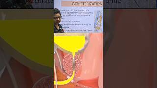 Catherization क्या है short gnm education catheter varshanursingclasses trending [upl. by Eentruok207]