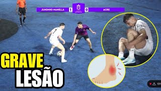 LESÃO GRAVE DE JUNINHO MANELLA NO LIGA DAS ESTRELAS  JUNINHO x ACRE X1 [upl. by Gahan]