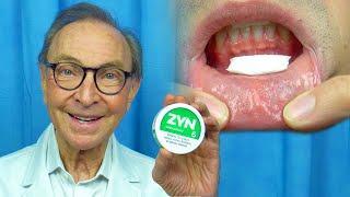 ZYN  Oral Health Risks and Benefits Reviewed by Dr Nemeth [upl. by Artinak]