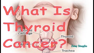 What is Thyroid Cancer [upl. by Amuwkuhc765]