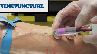 Venipuncture  How to take Blood  OSCE Guide old version  UKMLA  CPSA [upl. by Allina763]