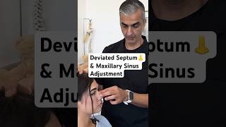 Deviated Septum amp Maxillary Sinus Adjustment chiropractic shorts [upl. by Ruth]