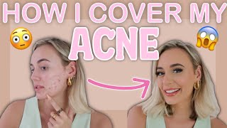 EVERYDAY MAKEUP ROUTINE  HOW I COVER MY ACNE [upl. by Anoyek]