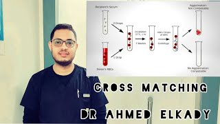 Cross Matching التوافق عملى [upl. by Janet288]