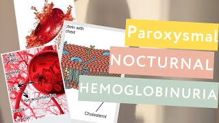 Paroxysmal Nocturnal Hemoglobinuria PNHDefinitionPathophysiologyTreatment [upl. by Japeth]