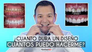 ¿Cuánto Dura un Diseño de Sonrisa ¿Cuántos diseños me puedo hacer  Odontología Láser [upl. by Jyoti611]