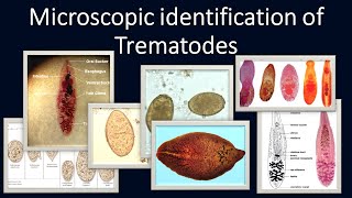 Microscopic identification of Trematodes [upl. by Atteragram830]