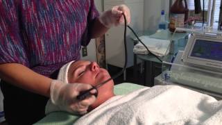 radio frequency ultra lift skin tightening [upl. by Olocin]