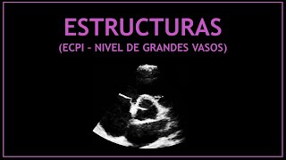 ESTRUCTURAS cardiacas  Ecocardiografía Grandes Vasos [upl. by Emmet]