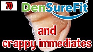 DenSureFit Fixed My Crappy Immediate Dentures [upl. by Scevo]