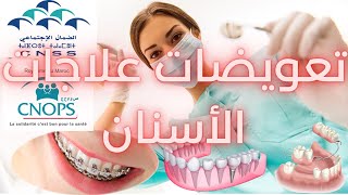 CNOPS CNSS حصريا طريقة حساب تعويضات علاجات الأسنان المعتمدة من طرف ✅ [upl. by Lavicrep]