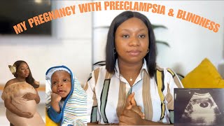 PREGNANCY STORY PREECLAMPSIA CAUSED ME BLINDNESS AND MY RECOVERY birthstory pregnancyjourney [upl. by Pillihp305]