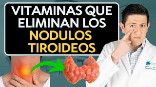 Como eliminar Nódulos en la Tiroides Dr Antonio Cota Sugar Care [upl. by Sakram273]