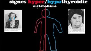 🔴 Dr Astuce  HYPERHYPOTHYROIDIES EXPLIQUÉES CLAIREMENT [upl. by Enirehtak]