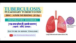 Pulmonary Tuberculosis  PTB in hindi  gnm 2nd year msn1 TB causes risk factorsymptom treatment [upl. by Naujled750]