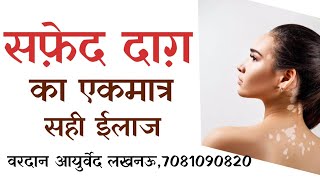 सफ़ेद दाग़ का जड़ से इलाज। वरदान आयुर्वेद लखनऊ। Safed daag ks ilasj। Vitiligo Treatment। Leucoderma [upl. by Laefar]