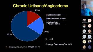 Urticaria and Angioedema Lang [upl. by Adekram]