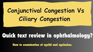 How to differentiate between Conjunctival Congestion and ciliary Congestion OptometryFans [upl. by Aramoj976]