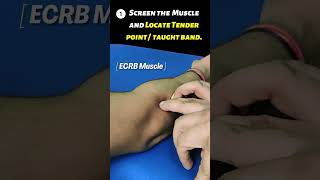 Tennis elbow exercises [upl. by Azyl465]